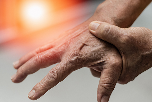 Person gripping their hand in pain. Bates, Miller, & Sims - Services, Chronic Pain Management